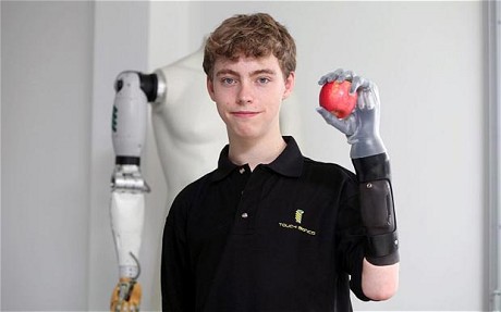 英殘疾男孩信件感動F1奔馳車隊 免費獲裝頂級仿生手